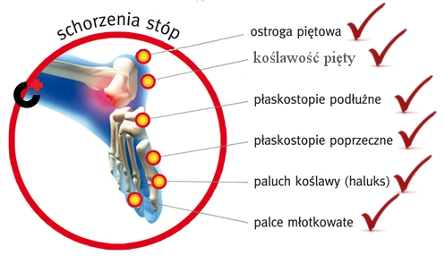 Schorzenia stóp 2
